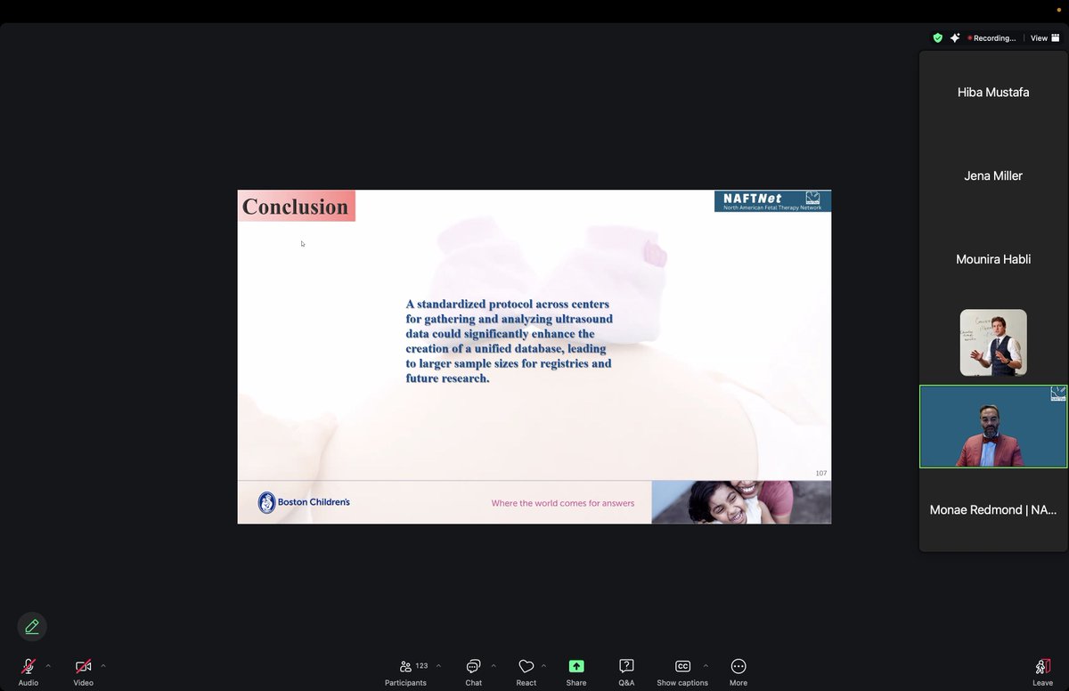 NAFTNet (@naftnet) on Twitter photo Our first #gastroschisis webinar speaker was NAFTNet's Steering Committee chair <a href="/AA_Shamshirsaz/">Alireza A Shamshirsaz, MD</a>, who dived into ultrasound predictors of morbidity and mortality....what an amazing lecture Our first #gastroschisis webinar speaker was NAFTNet's Steering Committee chair <a href="/AA_Shamshirsaz/">Alireza A Shamshirsaz, MD</a>, who dived into ultrasound predictors of morbidity and mortality....what an amazing lecture