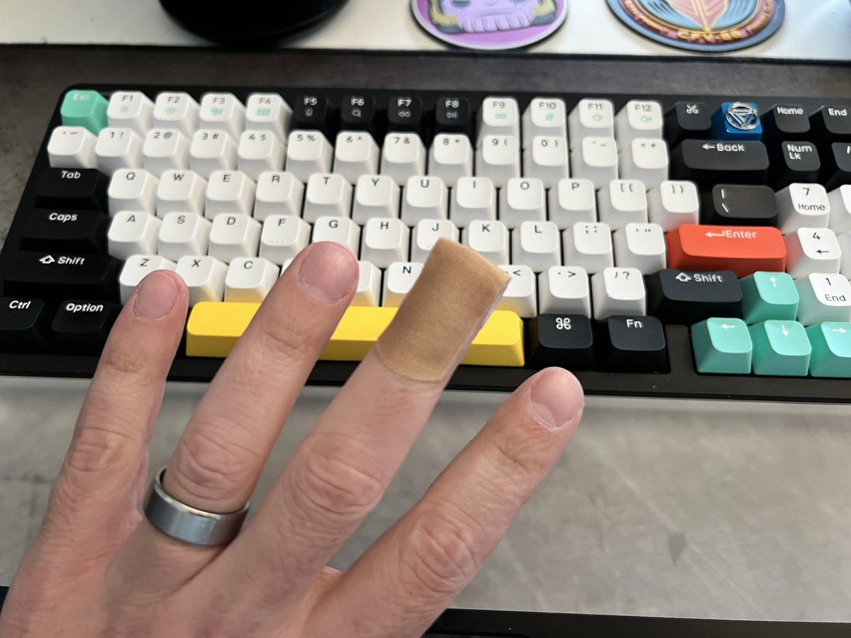 KCProcter's tweet image. Workplace injuries are less dramatic when you work from home. 🏠 

#RemoteWorkProblems