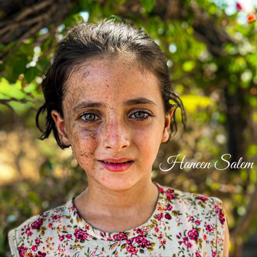 EyeonPalestine's tweet photo. What are wars? They are what come to deprive a child of his father, a wife of her husband, a grandfather of his grandchildren, and a father of his offspring. They are what come to leave a scar on the heart and face that will not heal no matter how much time tries to beautify it. https://t.co/odk9MHRANk