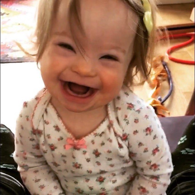 annamlulis's tweet photo. This child, with an extra chromosome, is valuable and worthy of life. https://t.co/zRAiSvepXm