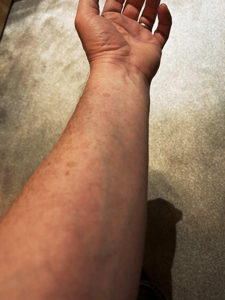 Dominic Brunt tweet media