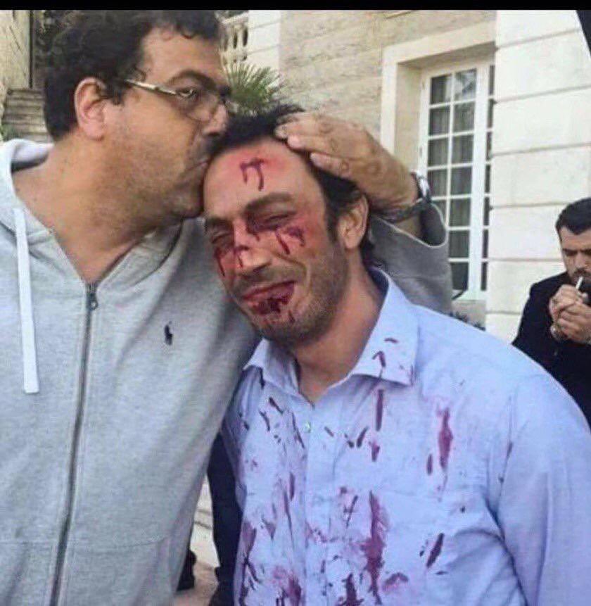 غدآ اجمل ...

إلغاء تأمين عافية

تغير نظام العمل 

ثلاث بصمات

إلغاء البدلات

قطع الكهرباء

شوارع مكسرة

سحب بيوت

فشل في تنظيم المباريات 

تعطل برنامج سهل

تعطل سستم وزارة الصحة

شكراً #مجلس_الوزراء على تلمسكم المستمر 😆