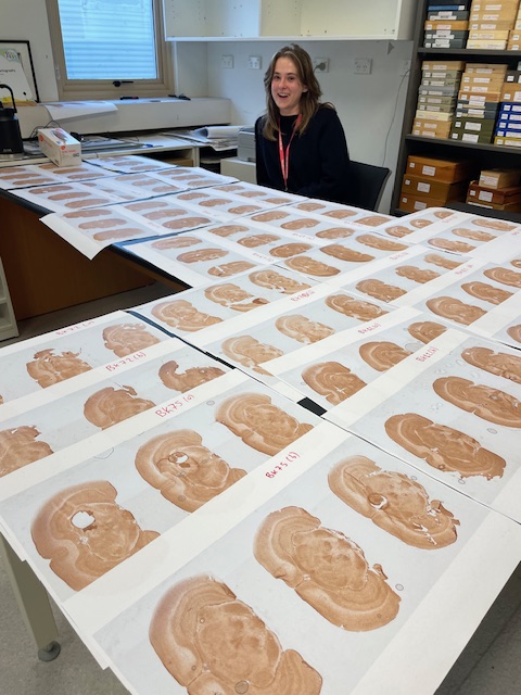 Dr. Tertia Purves-Tyson (@tertiatyson) on Twitter photo Collaboration & collegiality is key to good research! Expertise from Kristie Smith and Steve Kassem at <a href="/neuraustralia/">NeuRA (Neuroscience Research Australia)</a> and <a href="/Teri20565041/">Teri Furlong</a> from SBMS UNSW. Honours student Iveta Gavljak with microglia staining of brains from a preclinical study lead by <a href="/debs_sophie/">Sophie Debs</a>. Collaboration & collegiality is key to good research! Expertise from Kristie Smith and Steve Kassem at <a href="/neuraustralia/">NeuRA (Neuroscience Research Australia)</a> and <a href="/Teri20565041/">Teri Furlong</a> from SBMS UNSW. Honours student Iveta Gavljak with microglia staining of brains from a preclinical study lead by <a href="/debs_sophie/">Sophie Debs</a>.