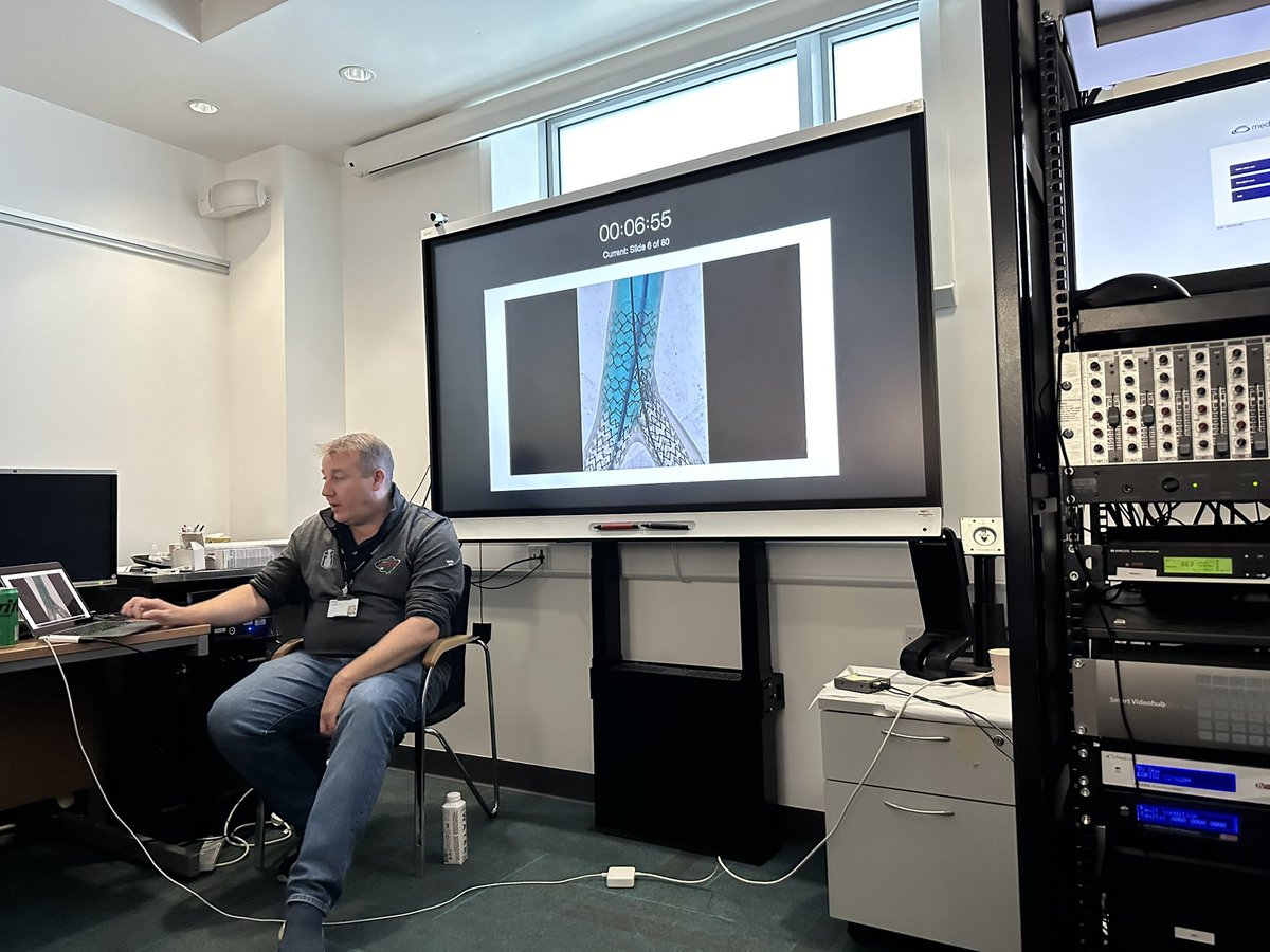 Jack Andrews (@jackandrews86) on Twitter photo Top talk from the simon Walsh about teo stent techniques in tue bifurcation disease (1,1,1 or 0,1,1) <a href="/ShockwaveIVL/">Shockwave Medical</a> <a href="/peterokane1435/">Peter O'Kane</a> <a href="/OptimaCTO/">Optima Education</a> <a href="/cghanratty/">@colmhanratty</a> <a href="/simonwalsh/">Simon Walsh</a> <a href="/BSCCardiology/">BostonSci Cardiology</a> Top talk from the simon Walsh about teo stent techniques in tue bifurcation disease (1,1,1 or 0,1,1) <a href="/ShockwaveIVL/">Shockwave Medical</a> <a href="/peterokane1435/">Peter O'Kane</a> <a href="/OptimaCTO/">Optima Education</a> <a href="/cghanratty/">@colmhanratty</a> <a href="/simonwalsh/">Simon Walsh</a> <a href="/BSCCardiology/">BostonSci Cardiology</a>