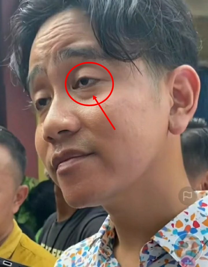 Saya yakin ini bukan gejala pemakai NARKOBA

Tapi karena Mas Gibran 24 jam memikirkan rakyat, bahkan dia sudah tidak memikirkan dirinya sendiri lagi demi BANGSA tercinta

Kalian masih tega memfitnah "beliau bukan sembarang beliau" yang diturunkan Tuhan untuk Indonesia agar