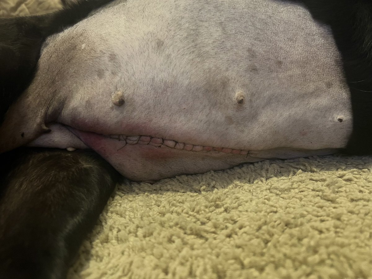 kimberlyalice78's tweet photo. It’s been a wild ride and any help is appreciated ❤️‍🩹. 

https://t.co/wusAatRPvD

#splenectomy https://t.co/ONdCzwGLkD