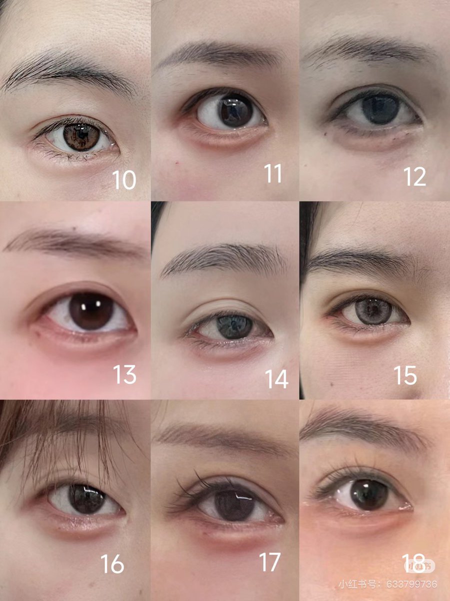 涙袋ヒアル入れる時参考になる✍️
5番みたいに涙袋でタレ目強調しようとすると一気に整形感出るから、ヒアルは15番or18番理想で黒目真下が一番ぷっくりするデザインが良き。