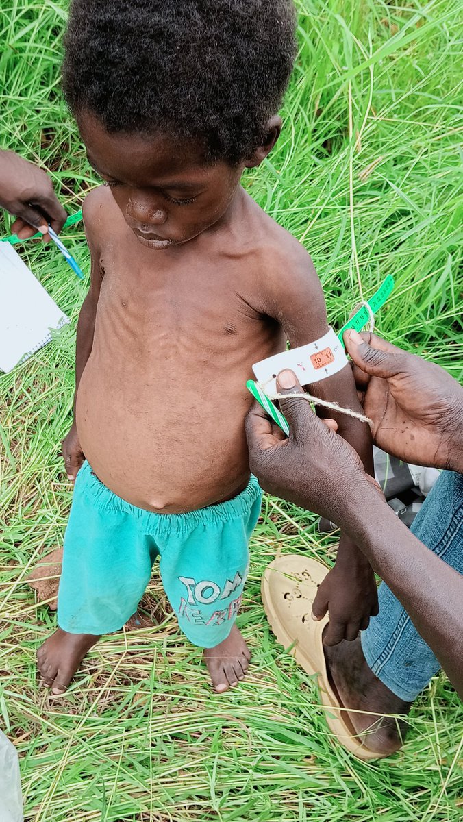 Since the famine was declared in the Nuba Mountains #Sudan, we've been raising awareness about the escalating crisis. The situation is devastating-children are dying, and our resources are stretched thin. We need your help. 
Please donate to our efforts: reframe.network/donate-now.php…