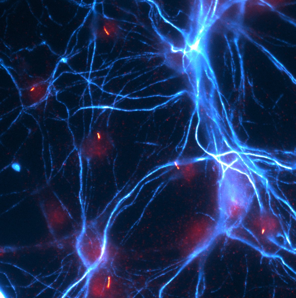 AxonsAlex's tweet image. Chicken commissural neurons stained for neurofilament-M (Cyan) and the primary cilium marker Arl13b (red). happy #FluoresenceFriday !