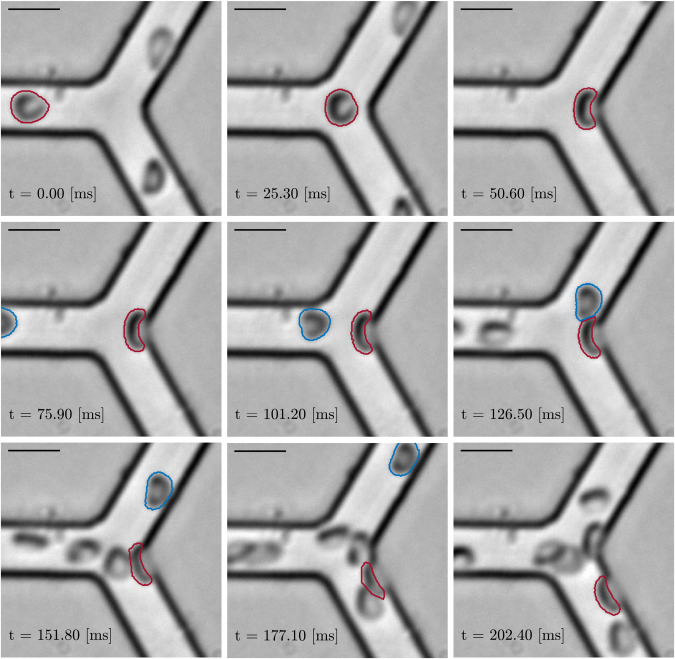 CVE_ARTORG's tweet photo. Lingering red blood cells in capillary networks may affect the hematocrit partitioning in following microvascular bifurcations - see the experimental study by Bucciarelli, Mantegazza &amp; @DominikObrist in Biophysical Journal https://t.co/Gwzu3OcIjR  @unibern @inselgruppe @polimi https://t.co/KgDLApEbvy