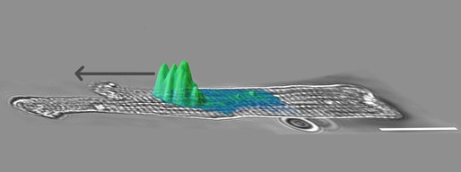 Niels Voigt (@niels_voigt) on Twitter photo New press release on our <a href="/CircAHA/">Circulation</a> paper with <a href="/dzhk_germany/">DZHK Germany</a> & <a href="/yourUMG/">Universitätsmedizin Göttingen (UMG)</a>: "Defective Ca2+ 'Shock Absorber' in heart muscle cells contributes to AF." Learn how impaired calcium buffering drives #AFib.
<a href="/funshofaks/">Faks</a> <a href="/HubrichtD/">Dominik Hubricht</a> @FleurEMason <a href="/MBExC_de/">MBExC</a> <a href="/pharmaumg/">Institute of Pharmacology and Toxicology, UMG</a>
dzhk.de/newsroom/aktue… New press release on our <a href="/CircAHA/">Circulation</a> paper with <a href="/dzhk_germany/">DZHK Germany</a> & <a href="/yourUMG/">Universitätsmedizin Göttingen (UMG)</a>: "Defective Ca2+ 'Shock Absorber' in heart muscle cells contributes to AF." Learn how impaired calcium buffering drives #AFib.
<a href="/funshofaks/">Faks</a> <a href="/HubrichtD/">Dominik Hubricht</a> @FleurEMason <a href="/MBExC_de/">MBExC</a> <a href="/pharmaumg/">Institute of Pharmacology and Toxicology, UMG</a>
dzhk.de/newsroom/aktue…