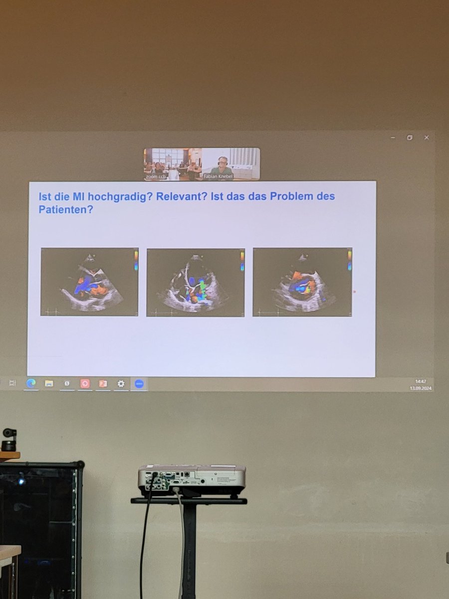 Young DGK (@youngdgk) on Twitter photo Vitiendiagnostik im TTE - absolut wichtig für jeden #YoungCardiologists: häufige Krankheitsbilder, weit verbreitete Methode. Klasse Vortrag von Fabian Knebel
<a href="/Echo_DGK_GER/">AG5-Kardiovaskulärer Ultraschall</a> #YoungDGKTrifftKardialeBildgebung Vitiendiagnostik im TTE - absolut wichtig für jeden #YoungCardiologists: häufige Krankheitsbilder, weit verbreitete Methode. Klasse Vortrag von Fabian Knebel
<a href="/Echo_DGK_GER/">AG5-Kardiovaskulärer Ultraschall</a> #YoungDGKTrifftKardialeBildgebung