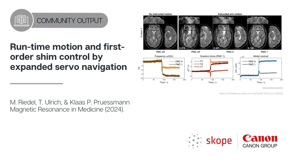 Skope (@skope_mri) on Twitter photo New <a href="/ETH_en/">ETH Zurich</a> paper using NeuroCam 3T for motion & noise correction of images is out. It has shown that the navigator-based method achieves accurate, high-precision run-time motion and field corrections with low sequence impact and calibration requirements. onlinelibrary.wiley.com/doi/10.1002/mr… New <a href="/ETH_en/">ETH Zurich</a> paper using NeuroCam 3T for motion & noise correction of images is out. It has shown that the navigator-based method achieves accurate, high-precision run-time motion and field corrections with low sequence impact and calibration requirements. onlinelibrary.wiley.com/doi/10.1002/mr…