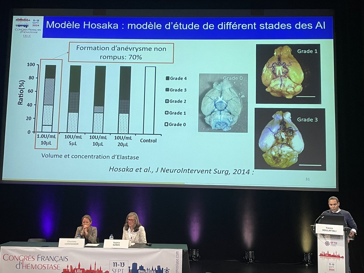 Congrès de la SFTH (@sfth_2025) on Twitter photo Excellente présentation par Yacine Boulaftali sur le rôle des plaquettes dans la formation et la rupture des anévrismes intracrâniens. Session modérée par les Pr <a href="/PrCCordonnier/">Charlotte Cordonnier</a> et <a href="/sophie_susen/">sophie susen</a>. <a href="/la_SFNV/">sfnv</a> <a href="/SFTHemostase/">SFTH</a> #CFH2024 Excellente présentation par Yacine Boulaftali sur le rôle des plaquettes dans la formation et la rupture des anévrismes intracrâniens. Session modérée par les Pr <a href="/PrCCordonnier/">Charlotte Cordonnier</a> et <a href="/sophie_susen/">sophie susen</a>. <a href="/la_SFNV/">sfnv</a> <a href="/SFTHemostase/">SFTH</a> #CFH2024