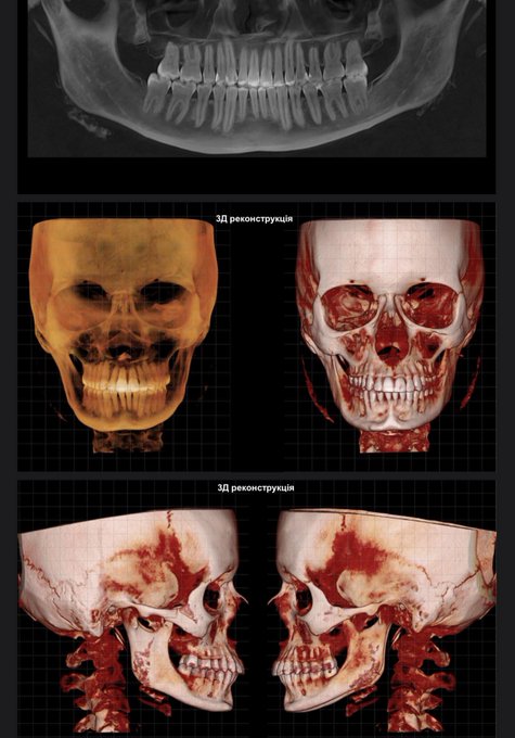 👱🏻&zwj;♂️: send nudes  me: https://t.co/yaOes6i78N
