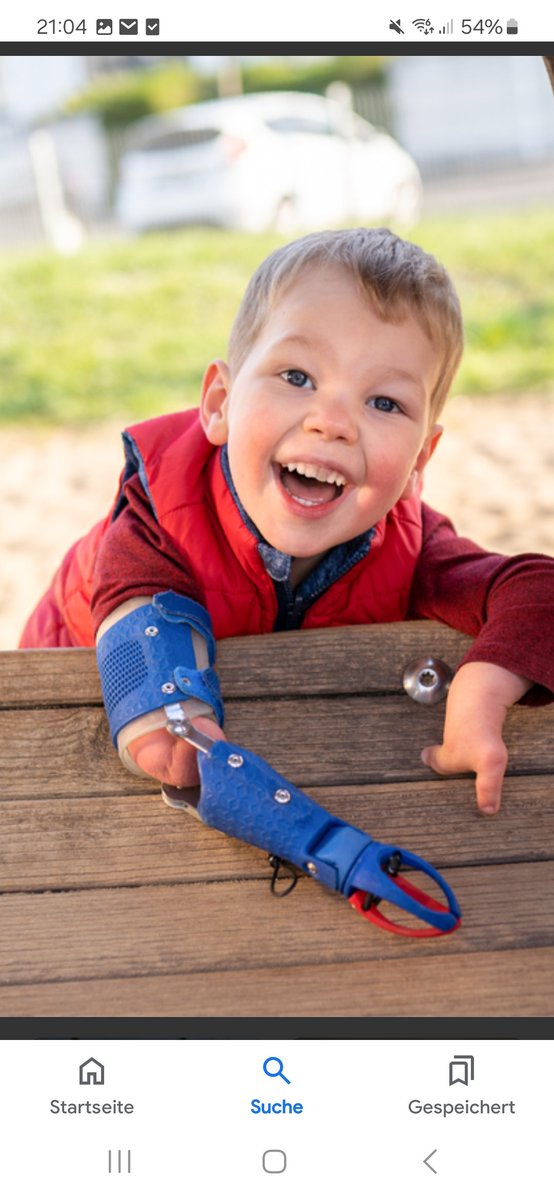 Prostheses for children gofund.me/6a0057ab