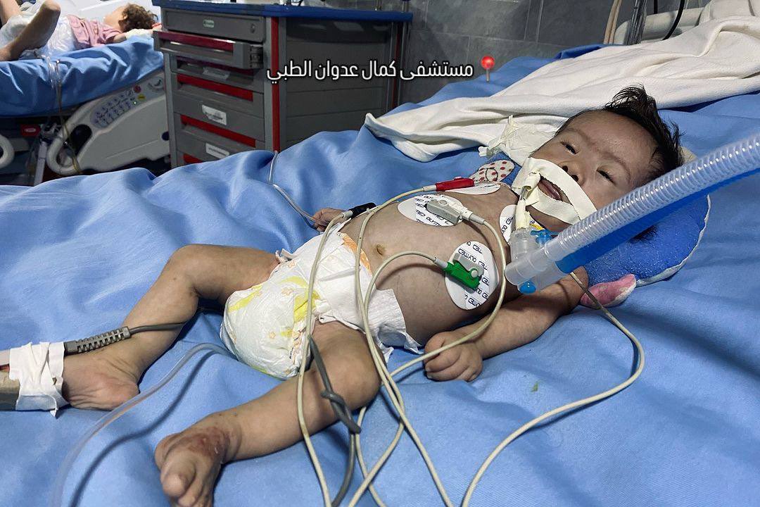 TIMES OF GAZA tweet media