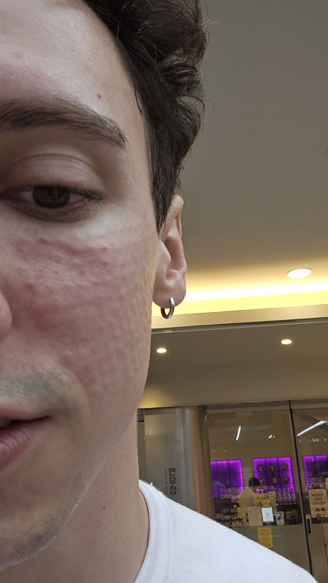 FLC TGLTN tweet media