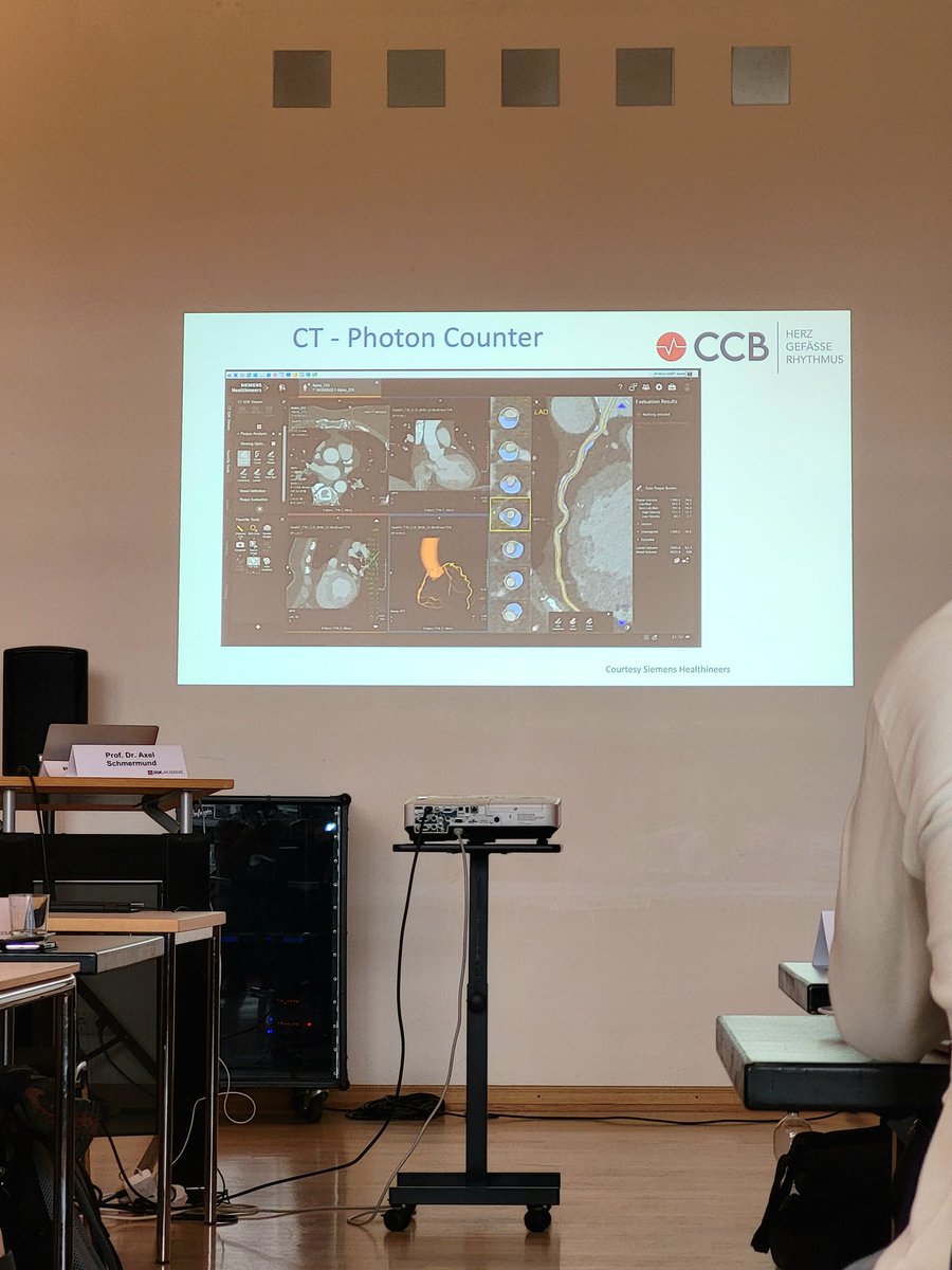 Young DGK (@youngdgk) on Twitter photo #YoungTrifftKardialeBildgebung - Axel Schmermund gibt unseren Youngs ein Update zur koronaren CTA - nach den neusten Leitlinien die Hauptmethode bei V.a. ein CCS
<a href="/DGK_org/">Deutsche Gesellschaft für Kardiologie</a> <a href="/Herzmedizin_de/">Herzmedizin.de</a> <a href="/BerkanKurtMD/">Berkan Kurt</a> <a href="/_Ramona_Schmitt/">Ramona Schmitt</a> <a href="/thiele_holger/">Holger Thiele</a> <a href="/doc_cardio/">Holger Eggebrecht</a> @cardio_doctorMD <a href="/Steph_Achenbach/">Stephan Achenbach</a> #YoungTrifftKardialeBildgebung - Axel Schmermund gibt unseren Youngs ein Update zur koronaren CTA - nach den neusten Leitlinien die Hauptmethode bei V.a. ein CCS
<a href="/DGK_org/">Deutsche Gesellschaft für Kardiologie</a> <a href="/Herzmedizin_de/">Herzmedizin.de</a> <a href="/BerkanKurtMD/">Berkan Kurt</a> <a href="/_Ramona_Schmitt/">Ramona Schmitt</a> <a href="/thiele_holger/">Holger Thiele</a> <a href="/doc_cardio/">Holger Eggebrecht</a> @cardio_doctorMD <a href="/Steph_Achenbach/">Stephan Achenbach</a>