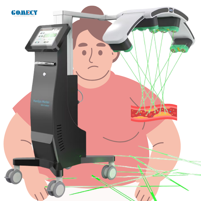 Janet46035559's tweet image. With EMS slimming and laser technology, you don’t have to choose one over the other. These two methods can work together to deliver even better results!

gomecy.com
Janet:+86 15387315895
Mail:janet@gomecy.com

#EMSSlimming
#LaserTechnology
#NonInvasive