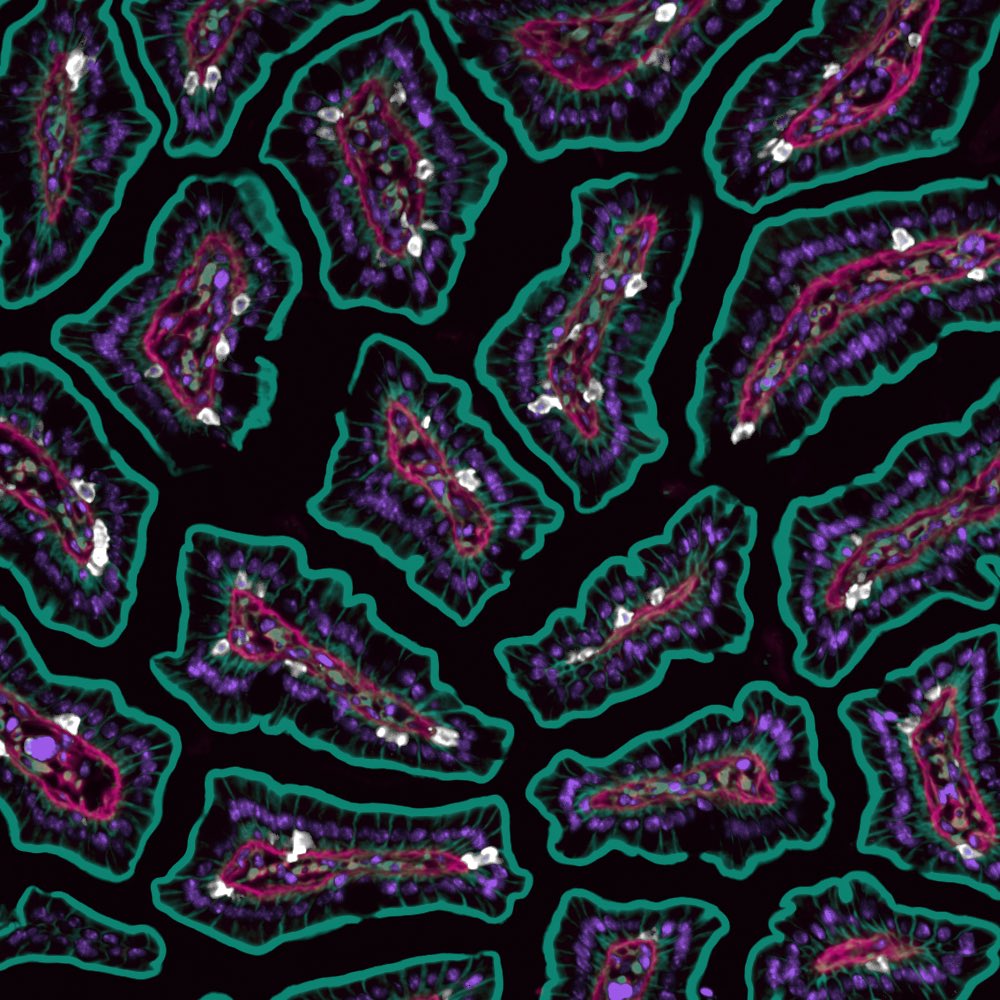 andrew_fong_'s tweet photo. Not so dizzying villi for
#FluorescenceFriday https://t.co/91LUkQk747