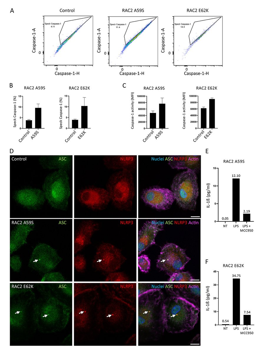 JExpMed's tweet photo. The Boyer group @lauboye @Univ_CotedAzur @Inserm show that inhibiting the RAC2–PAK1–NLRP3 #inflammasome pathway might be considered as a potential treatment for patients presenting severe combined immunodeficiencies attributed to monoallelic RAC2 variants. https://t.co/Pg5mw0NTKU https://t.co/altDMXtLjW