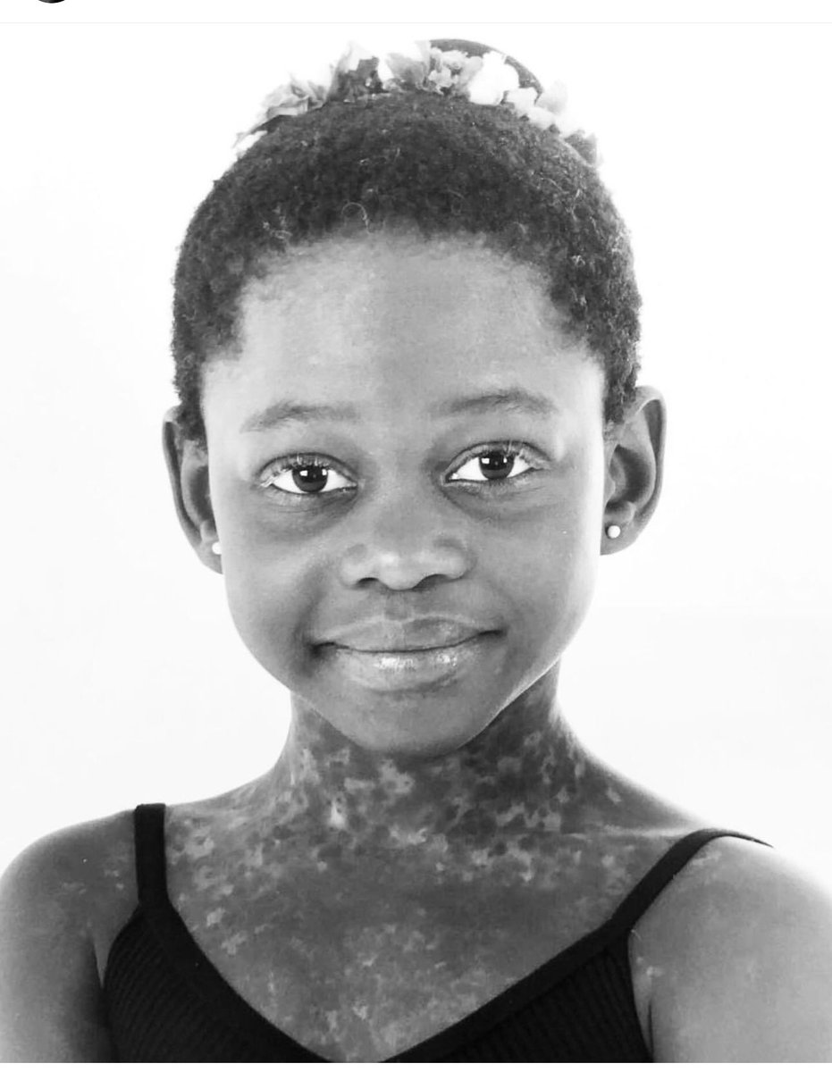 VickieRemoe's tweet photo. Devastating news😭

Sierra Leonean-American ballerina Michaela Mabinty DePrince has passed away. The news of her passing was announced on her official instagram page. No cause of death was given. She was 29.

https://t.co/cm6mhvGKl0 https://t.co/pl053xfgIP