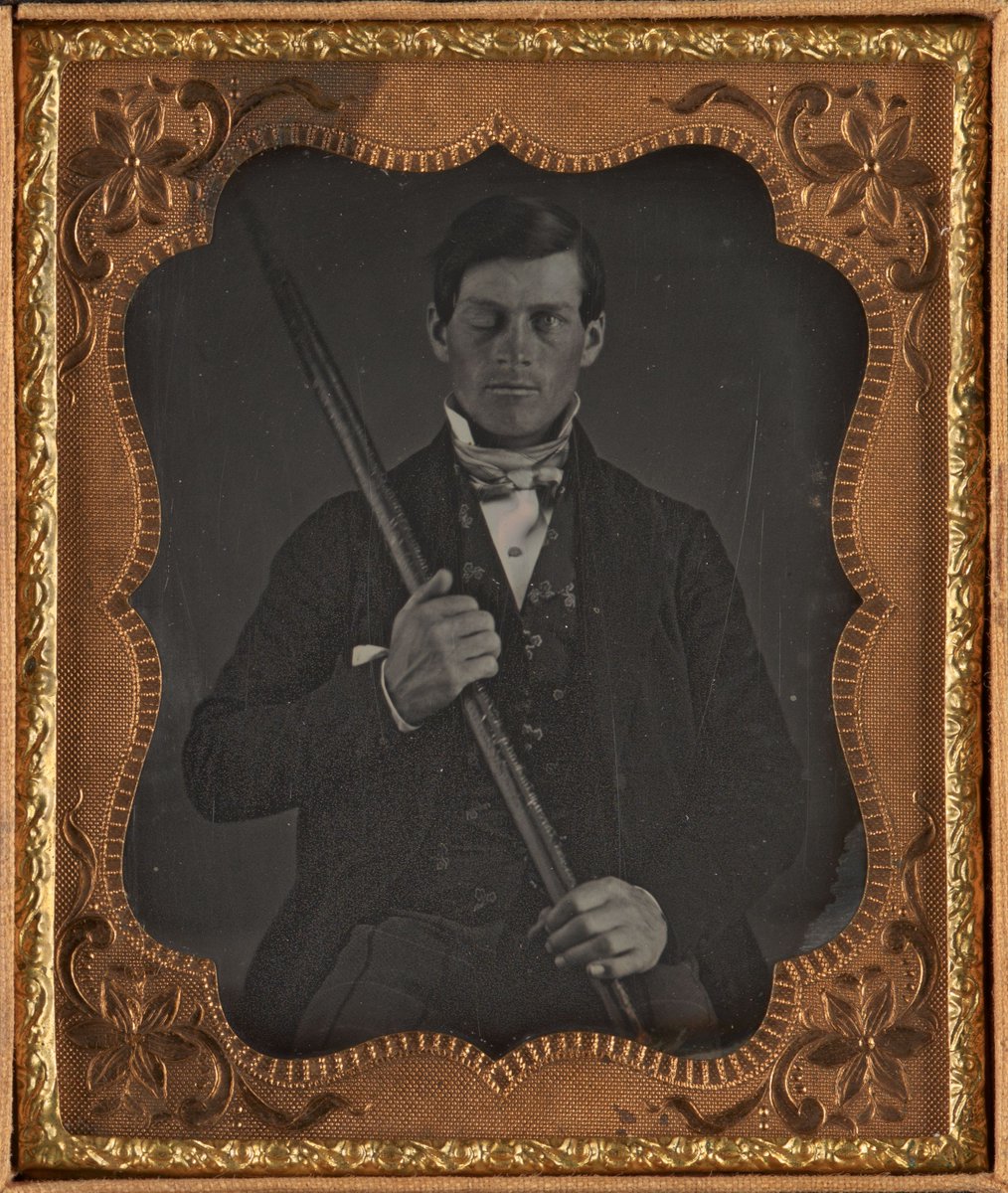 176 years ago, rail worker Phineas Gage was clearing the way for a rail line in Vermont when a 3-foot, 7-inch, iron rod accidentally pierced through his head. His improbable survival has long intrigued researchers and prompted studies about brain trauma and personality change.