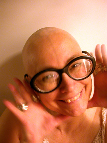 It’s National Bald Is Beautiful Day!
Here’s me in my bald phase, 2010.