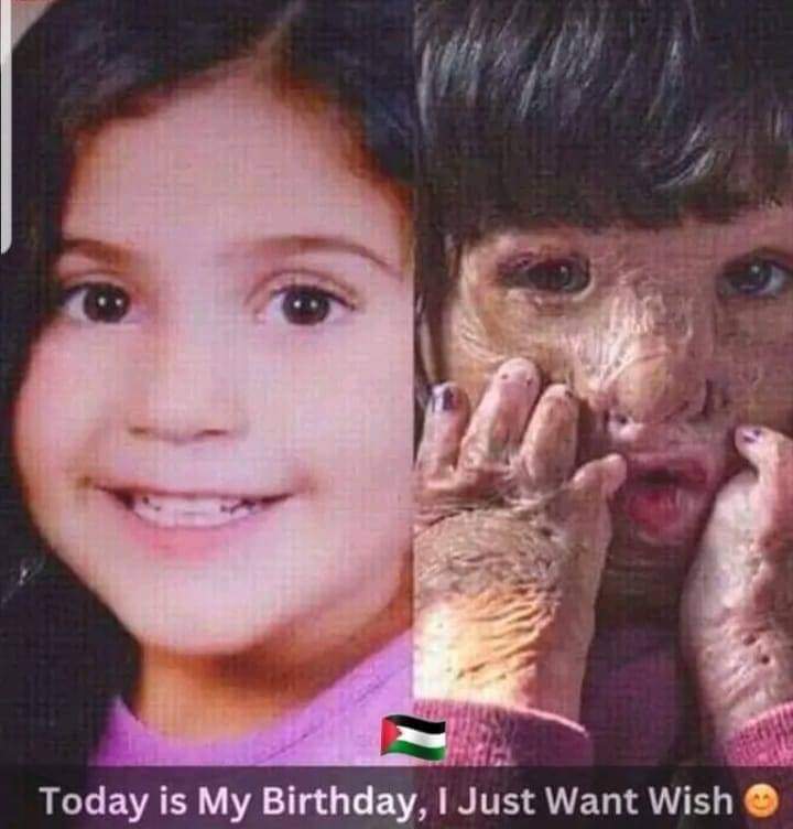 هذه تعكس الصورة الحقيقية للاجرام الصهيوني والامريكي 
غزة تستغيث اللهم اغثهم وايدهم بنصرك  .