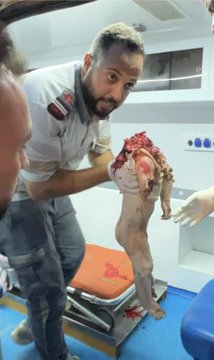 جريم العدوان الإسرائيلي على الاطفال في قطاع غزة
وحكام العرب  خانعين عليهم لعنت الله