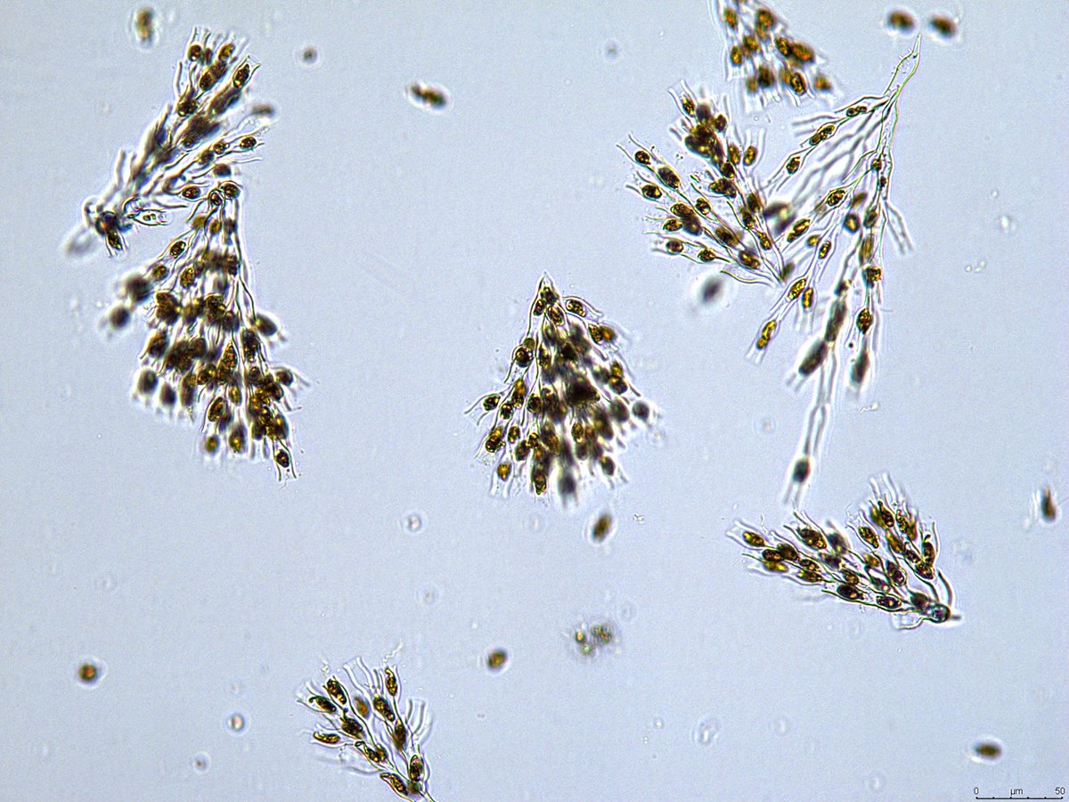 Dinobryon party at Bald Hill Pond in Westmore, VT 🎉 💃

#phycologyfriday #PhytoplanktonDeserveGlamorShotsToo