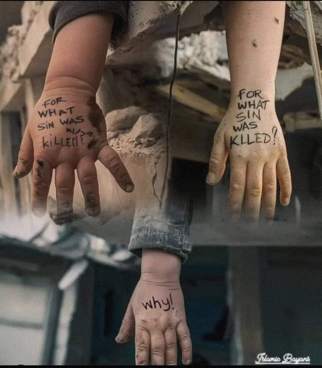 Emelia8z0's tweet photo. Every hand has a story…💔 https://t.co/2Ab4kcq4eB