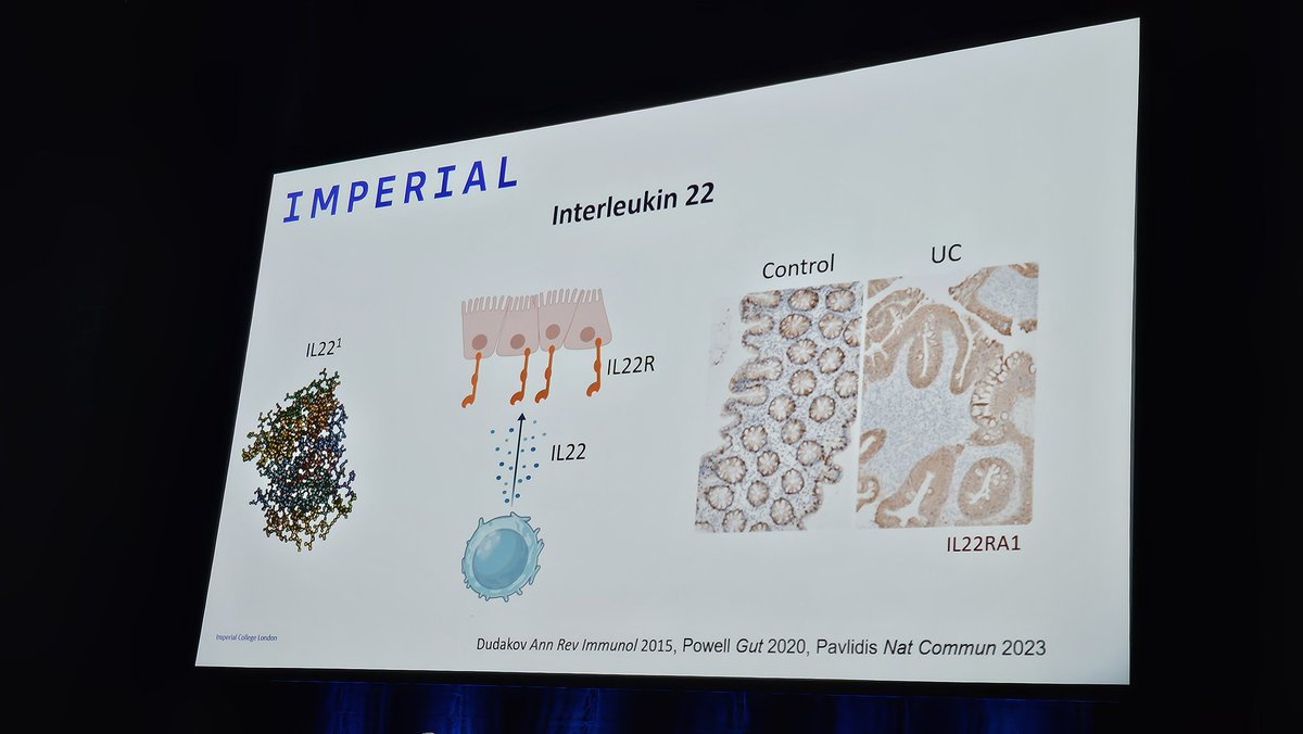 stevenbollipo's tweet photo. I normally switch off when I see a basic science slide but @NickPowellLab now got me fascinated by IL22! I wish all translational researchers could present concepts so clearly for simple clinical people like me 🤯
@AGWmeeting #AGW2024 #AGW24 https://t.co/5gWxAXNrB6