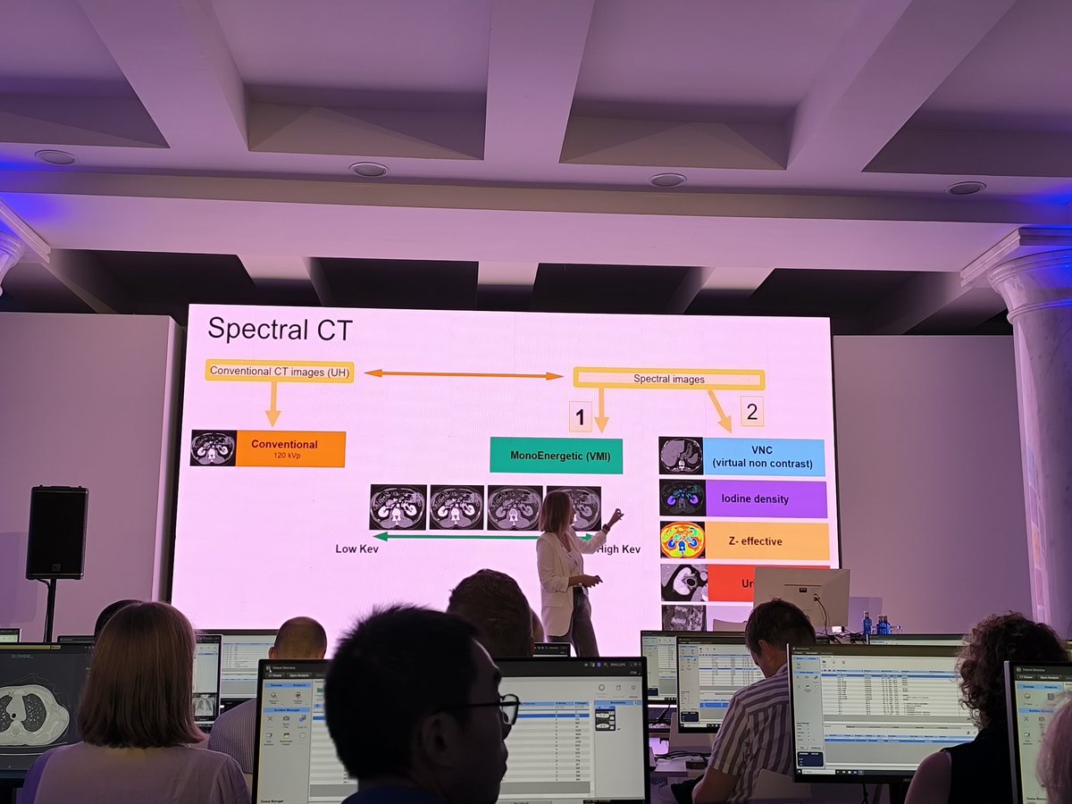 Sara Gomez (@sagompe) on Twitter photo Muchos trucos aprendidos en el 19th MDCT Philips user meeting para poner en práctica ✏️🤓⚡
<a href="/RMyTC_Rosario/">RM y TC Rosario</a> #philipsCT Muchos trucos aprendidos en el 19th MDCT Philips user meeting para poner en práctica ✏️🤓⚡
<a href="/RMyTC_Rosario/">RM y TC Rosario</a> #philipsCT