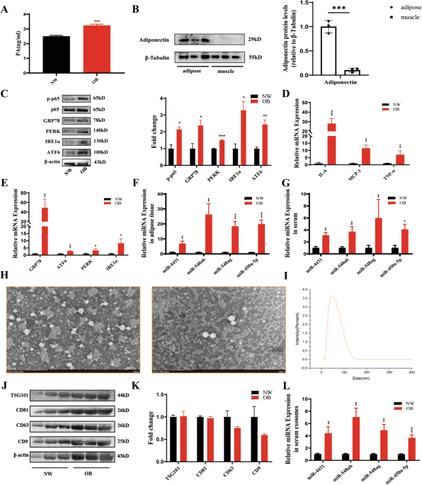 Palmitic acid promotes miRNA release from adipocyte exosomes by activating NF-κB/ER stress dlvr.it/TDD7cd
