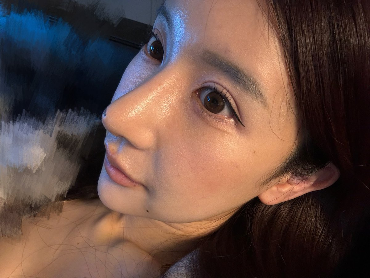 横顔 綺麗な横顔にこだわり続けてた。 術後10日目でこれは、、腫れが引き