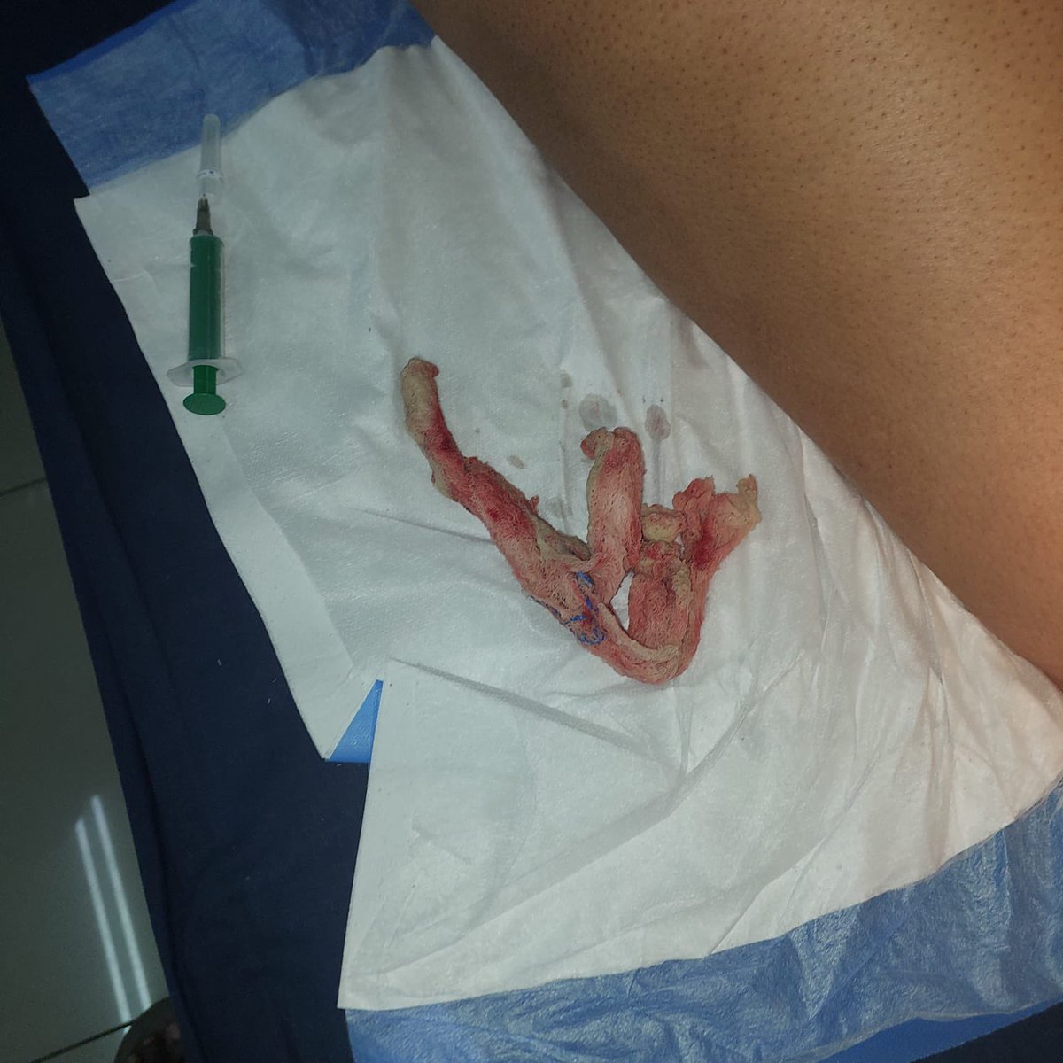 Manyawuza tweet media