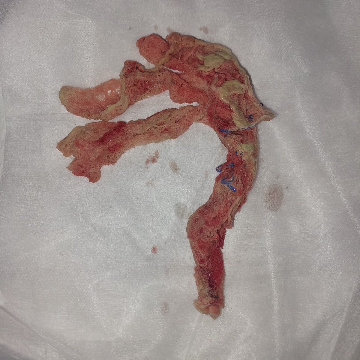 Manyawuza tweet media