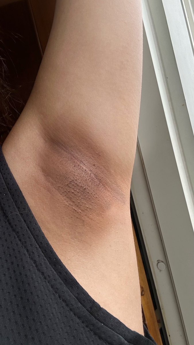 godjihyosoo's tweet photo. ASLI BEST BUY tahun 2024 ku ini!!! ga bikin abu-abu, iritasi, terlalu lembab, tapi bikin KETIAK CERAHAN BANGETTTT

desclaimer : ketiak aku bisa segelap itu gara gara deodoran :( https://t.co/OFOnlegisL