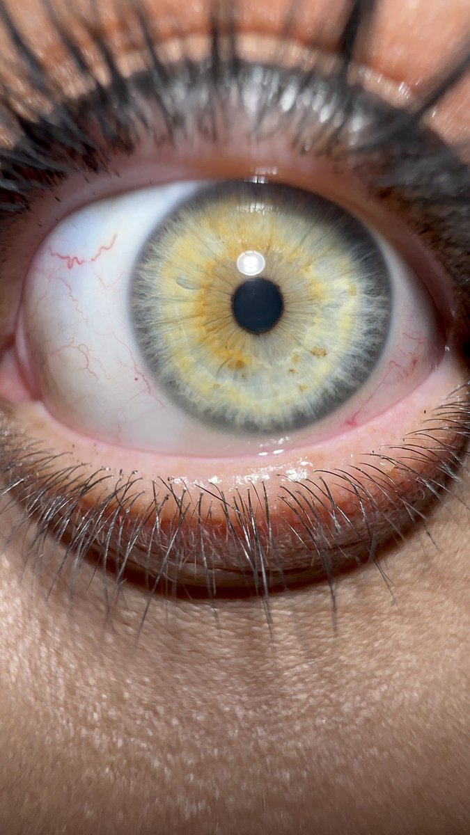 عکسی که دوس پسرم از چشمم گرفته :