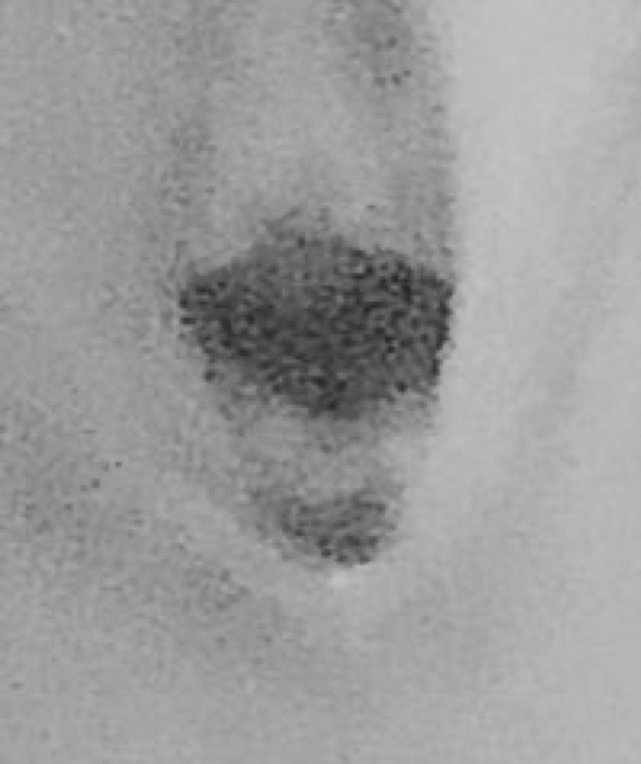 これなにかわかりますか？恥ずかしい...
おそらくみなさん正解です🧏‍♀️

るな最強