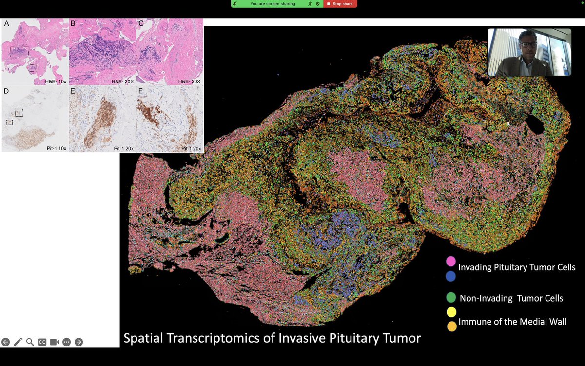 Ahmed Mohyeldin MD PhD tweet media