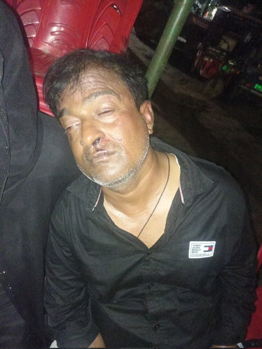 उन्नाव जिले की गंगा घाट कोतवाली क्षेत्र के अंतर्गत दबंगों ने घर में घुस कर महिलाओं और बेटियों से की अभद्रता,पिता द्वारा कोतवाली में शिकायत करने को लेकर दबंगों ने पिता को लहूलुहान कर दिया <a href="/dgpup/">DGP UP</a> <a href="/Igrangelucknow/">IG Range Lucknow</a> <a href="/Uppolice/">UP POLICE</a> <a href="/unnaopolice/">UNNAO POLICE</a>