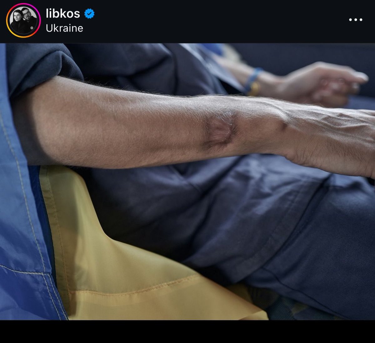 eurovanya's tweet photo. share photos of Azovstal defenders arriving home, so more people could see them

these heroes skinny hands, freed from the clutches of death, speak louder than words https://t.co/q3wSZpWsZJ