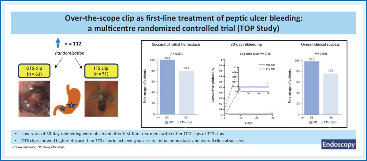 🔥🩸🔥🩸Over-the-scope clip as first-line treatment of peptic #ulcer bleeding

🆕️ data on #OTS clip as first-line treatment in gastroduodenal #bleeding 🔥🩸🔥🩸

📘 in <a href="/endoscopyjrnl/">Endoscopy Journal</a> 🤗
👉tinyurl.com/47zw9zzb

<a href="/ESGE_news/">ESGE</a> <a href="/iangralnek/">Ian M. Gralnek MD, MSHS, FESGE, FASGE</a> 
<a href="/ThiemeIntl/">Thieme International</a>
<a href="/DrBloodandGuts/">Andy Tau, MD</a>
#GITwitter