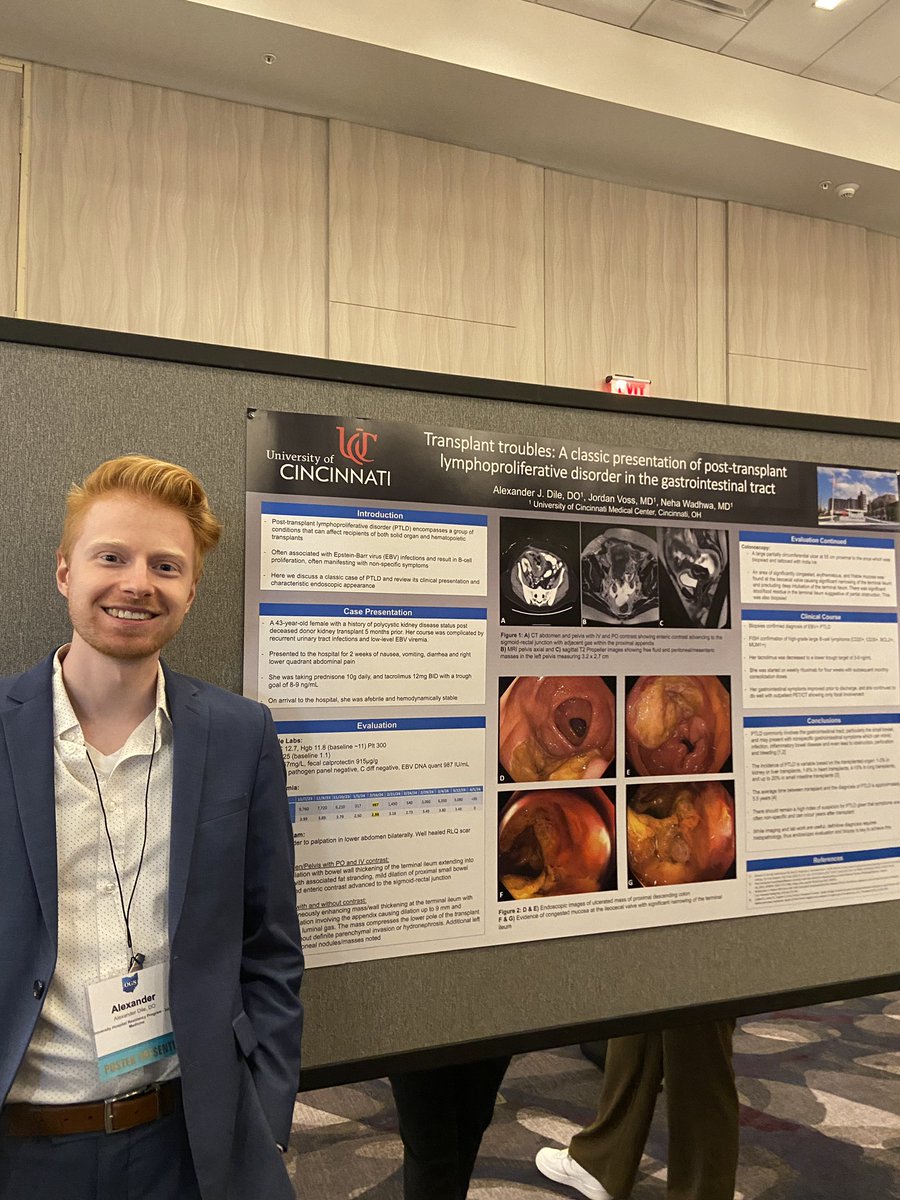Alexander Dile, DO (@alexanderjdile) on Twitter photo Glad to represent @UCincyIM in Columbus this weekend for the annual OGS meeting with my poster on PTLD!
<a href="/UCMCGIHEP/">University of Cincinnati GI and Hep</a>
<a href="/OHgastrosociety/">Ohio Gastroenterology Society</a> Glad to represent @UCincyIM in Columbus this weekend for the annual OGS meeting with my poster on PTLD!
<a href="/UCMCGIHEP/">University of Cincinnati GI and Hep</a>
<a href="/OHgastrosociety/">Ohio Gastroenterology Society</a>