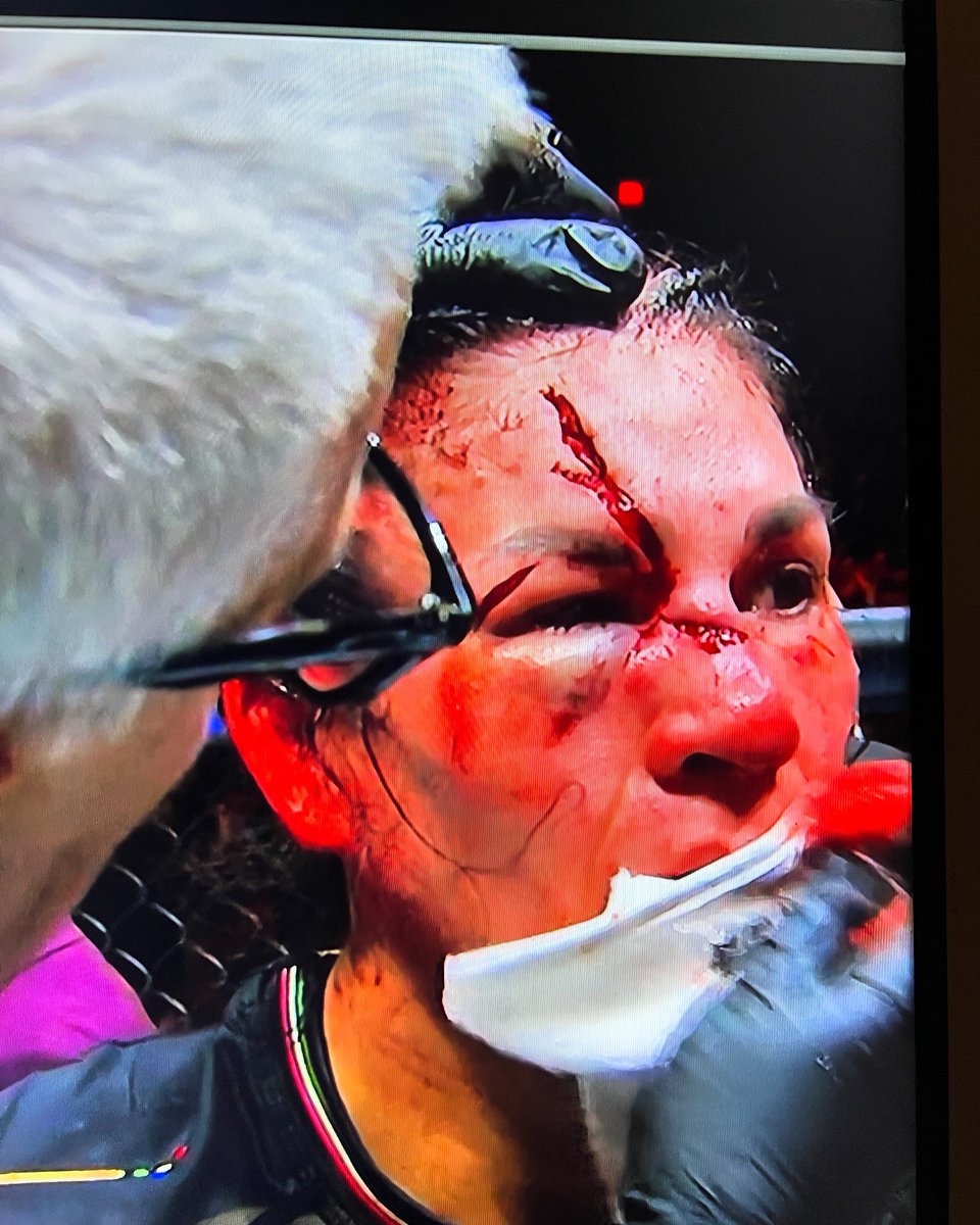 El corte de Irene Aldana 😔 #Nocheufc