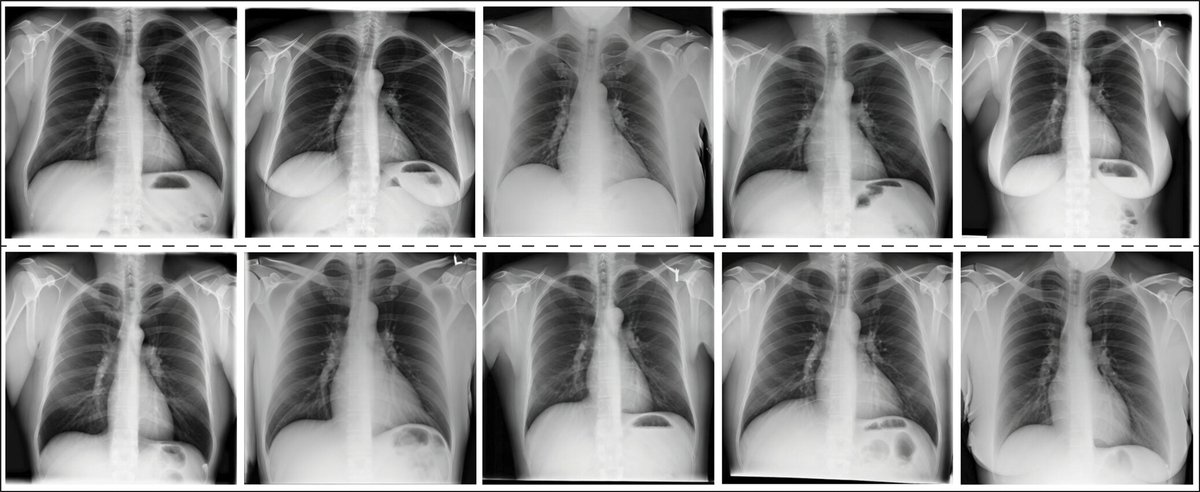 Radiology (@radiology_rsna) on Twitter photo Read about the benefits of synthetic data as well as the challenges in generating and applying synthetic data and how they might be overcome. <a href="/KoetzierLennart/">Lennart Koetzier</a> <a href="/Mastrodicasa_MD/">Domenico Mastrodicasa</a> <a href="/wkoszek/">Adam Koszek 🥁🅈</a> <a href="/pranavrajpurkar/">Pranav Rajpurkar</a> <a href="/mattlungrenMD/">Matthew Lungren MD MPH</a> <a href="/MWillemink/">Martin Willemink</a> pubs.rsna.org/doi/10.1148/ra… Read about the benefits of synthetic data as well as the challenges in generating and applying synthetic data and how they might be overcome. <a href="/KoetzierLennart/">Lennart Koetzier</a> <a href="/Mastrodicasa_MD/">Domenico Mastrodicasa</a> <a href="/wkoszek/">Adam Koszek 🥁🅈</a> <a href="/pranavrajpurkar/">Pranav Rajpurkar</a> <a href="/mattlungrenMD/">Matthew Lungren MD MPH</a> <a href="/MWillemink/">Martin Willemink</a> pubs.rsna.org/doi/10.1148/ra…