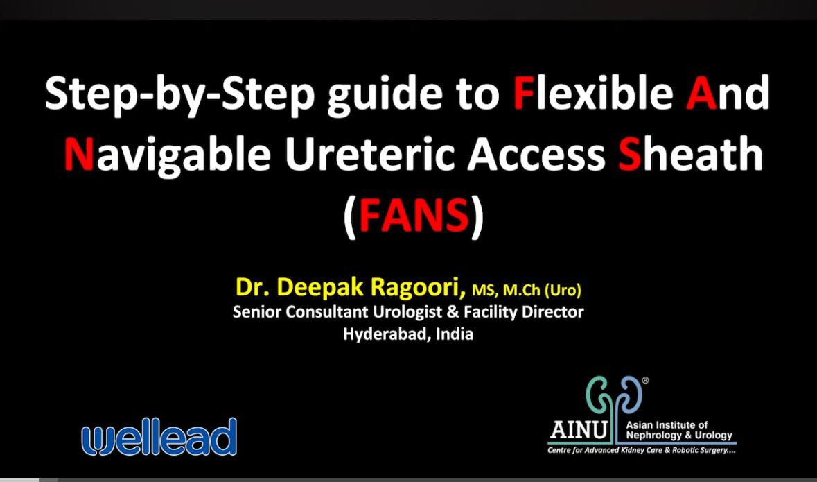 ๐ฟ๐๐๐ฅ๐๐ ๐๐๐๐ค๐ค๐ง๐ (@drragoori) on Twitter photo Step-by-Step Guide to Flexible And Navigable Ureteric Access Sheath (FANS) Click ๐๐ผ youtu.be/DDAHRH-eiGE?siโฆ via <a href="/YouTube/">YouTube</a>
<a href="/ainuindia/">Asian Institute of Nephrology and Urology</a> <a href="/JustineShi_js/">@ClearPetra-Well Lead</a> <a href="/Bioradmed_India/">Biorad Medisys Pvt. Ltd.</a> <a href="/usioffice/">Urological Society of India ๐ฎ๐ณ</a> <a href="/Uroweb/">European Association of Urology (EAU)</a> <a href="/CAU_URO/">Confederaciรณn Americana de Urologรญa (CAU)</a> <a href="/AmerUrological/">Amer. Urol. Assn.</a> <a href="/Endo_Society/">Endourological Society</a> <a href="/arab_asu/">Arab School Of Urology (ASU)</a> <a href="/SIU_urology/">SIU-Urology</a> #FANS Step-by-Step Guide to Flexible And Navigable Ureteric Access Sheath (FANS) Click ๐๐ผ youtu.be/DDAHRH-eiGE?siโฆ via <a href="/YouTube/">YouTube</a>
<a href="/ainuindia/">Asian Institute of Nephrology and Urology</a> <a href="/JustineShi_js/">@ClearPetra-Well Lead</a> <a href="/Bioradmed_India/">Biorad Medisys Pvt. Ltd.</a> <a href="/usioffice/">Urological Society of India ๐ฎ๐ณ</a> <a href="/Uroweb/">European Association of Urology (EAU)</a> <a href="/CAU_URO/">Confederaciรณn Americana de Urologรญa (CAU)</a> <a href="/AmerUrological/">Amer. Urol. Assn.</a> <a href="/Endo_Society/">Endourological Society</a> <a href="/arab_asu/">Arab School Of Urology (ASU)</a> <a href="/SIU_urology/">SIU-Urology</a> #FANS